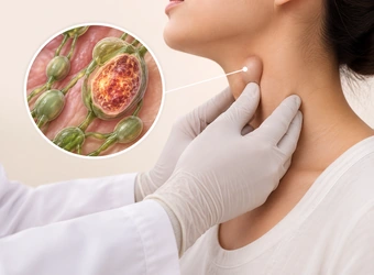 Lymphoma