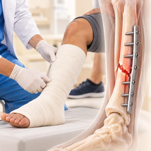 Orthopedic Trauma
